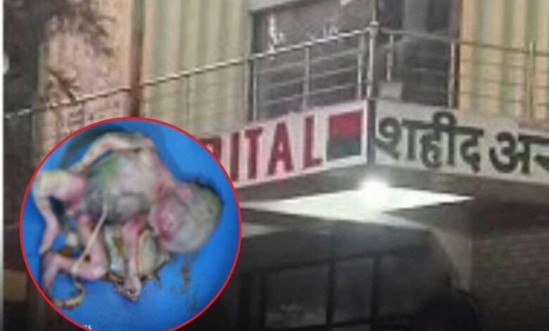 हॉस्पिटल के टॉयलेट में मिला नवजात का शव, क्षेत्र में मचा हड़कंप