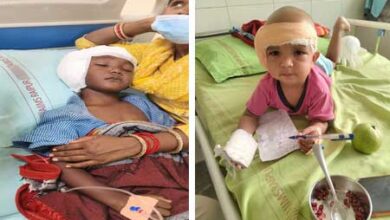 राष्ट्रीय बाल स्वास्थ्य कार्यक्रम (चिरायु) का असर: जन्मजात बधिरता से जूझ रहे तीन बच्चों का एम्स रायपुर में सफल कॉक्लियर इंप्लांट