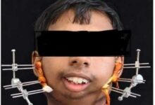 जटिल सर्जरी से खुला मुंह, आयुष्मान योजना से मिला निःशुल्क उपचार