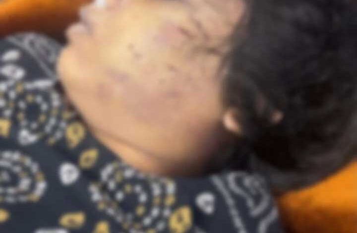 रायपुर में बीएड छात्रा की मौत का मामला, मारपीट के आरोपों के बीच हत्या की जांच शुरू