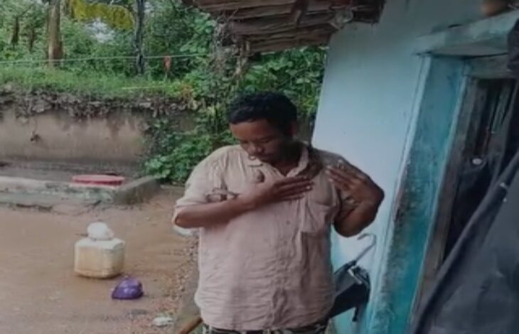 जहरीले सांप को गले में लपेटकर गांव में घूमता रहा युवक: नशे में अस्पताल से भी भागा
