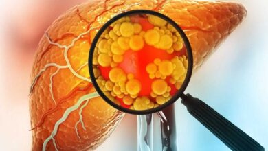Fatty Liver: 5 Vegetables That May Support Liver Health Fatty Liver: 5 Vegetables That May Support Liver Health