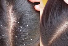 Hair Care Tips: लंबे, घने और चमकदार बालों के लिए इस्तेमाल करें अमरूद की पत्तियां, जानें तरीका