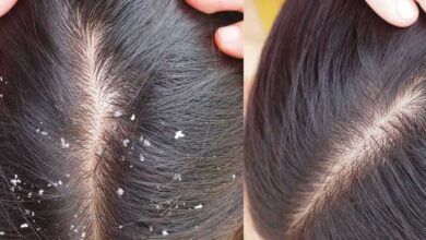 Hair Care Tips: लंबे, घने और चमकदार बालों के लिए इस्तेमाल करें अमरूद की पत्तियां, जानें तरीका