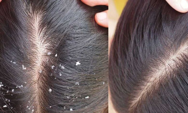 Hair Care Tips: लंबे, घने और चमकदार बालों के लिए इस्तेमाल करें अमरूद की पत्तियां, जानें तरीका